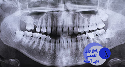 تحویل فوری نتایج و دریافت لینک گزارش‌ها؛ سرعت و دقت در خدمت بیماران